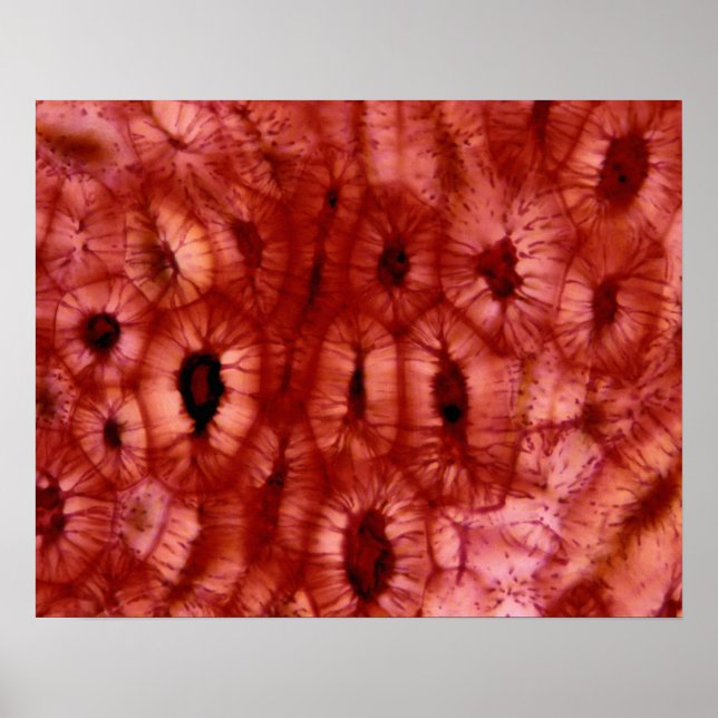 Poster Células esclerenchymas de poço de cereja (Frente)