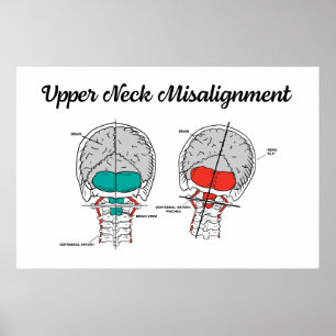 Poster Cervical Superior Quiroprático