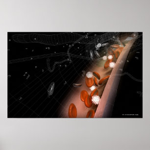 Pôster Chapa nas artérias