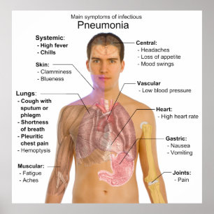Poster Chart of the Symptoms of Pneumonia