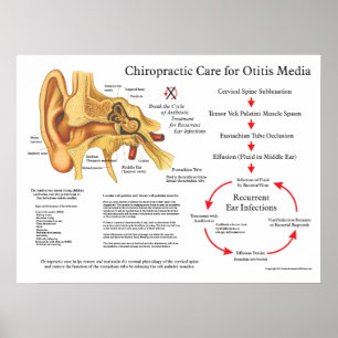 Poster Chiropractic: Tratamento das infecções auriculares