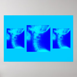 Poster Chiroprático: Blues Cervical Laterais