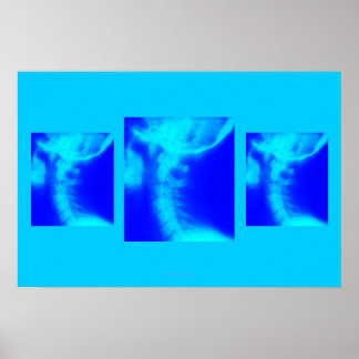 Poster Chiroprático: Blues Cervical Laterais