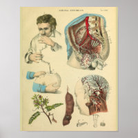 Cirurgia cerebral Anatomia da cabeça Médico Impres