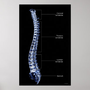 Pôster Coluna Vertebral 3