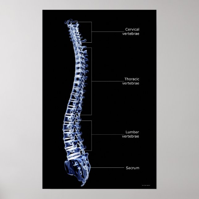Pôster Coluna Vertebral 3 (Frente)