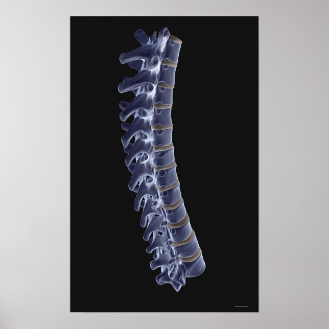 Poster Coluna Vertebral 3 (Frente)