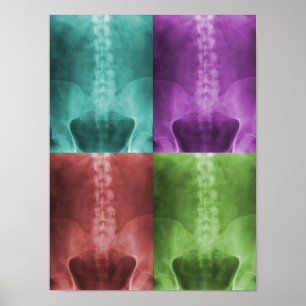 Poster das canvas de arte do raio X de Digitas
