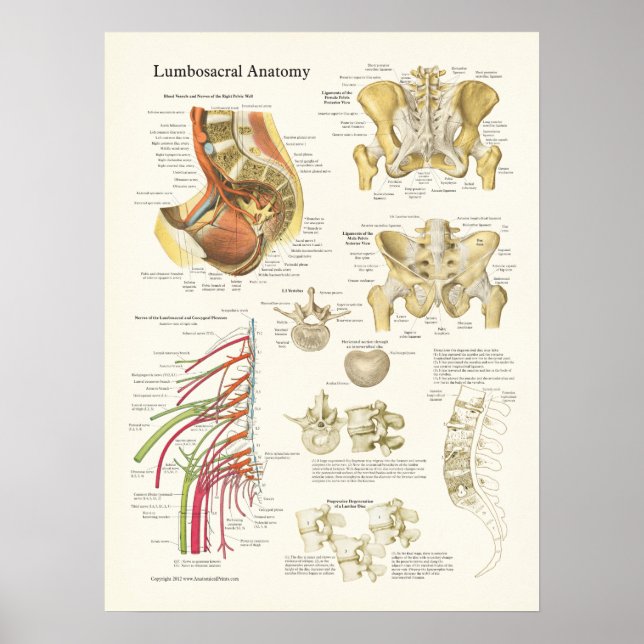Poster de Anatomia Lumbossacral e degeneração da c (Frente)