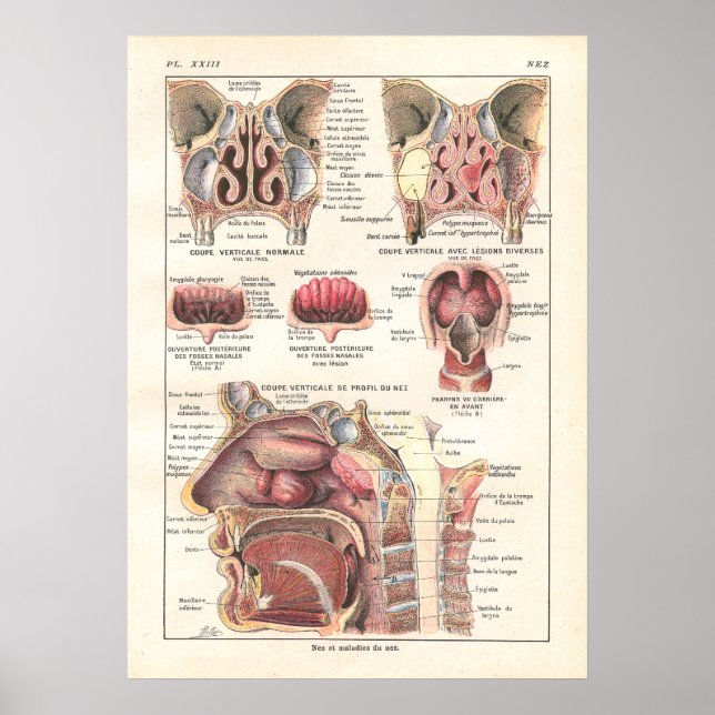 Poster de Anatomia Nariz e Sinusos em Francês (Frente)
