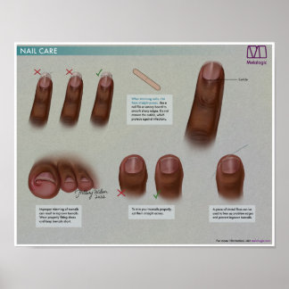 Poster de Medicina para Cuidados de unhas Melalogâ