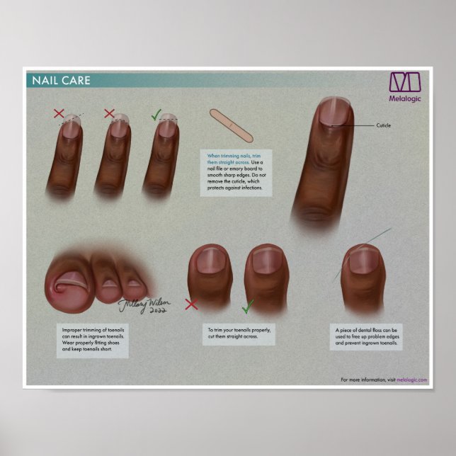 Poster de Medicina para Cuidados de unhas Melalogâ (Frente)