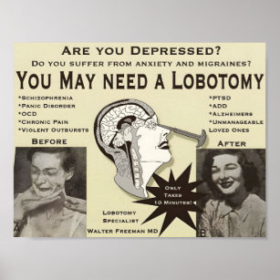 Poster de propaganda de lobotomia   Anúncio Vintag