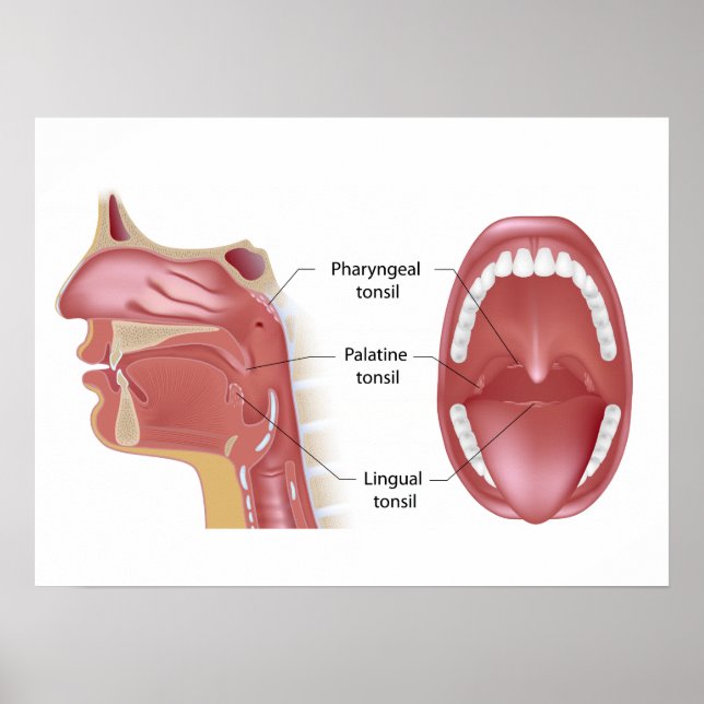 Poster de Tonsils (Frente)