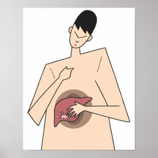 Poster Detecção precoce de doenças hepáticas.