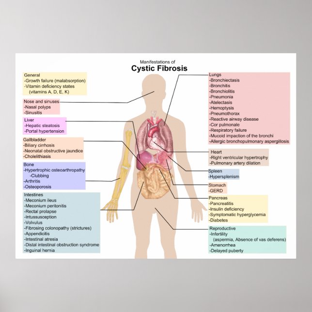 Poster Diagrama das Manifestações de Fibrose Cística (Frente)