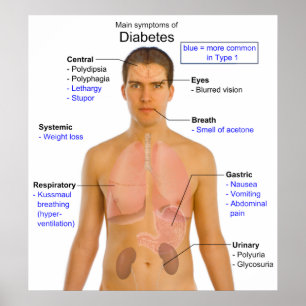 Pôster Diagrama dos sintomas principais do diabetes nos