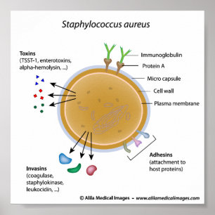 Pôster Diagrama marcado pela bactéria Staphylococcus aure