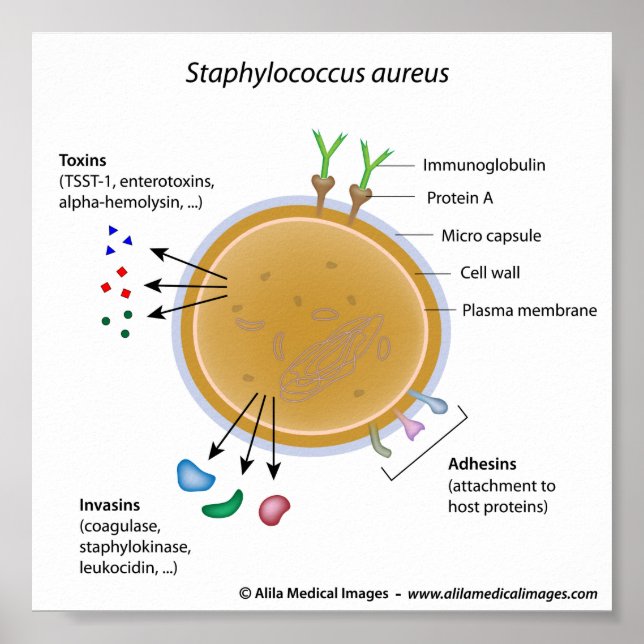 Pôster Diagrama marcado pela bactéria Staphylococcus aure (Frente)
