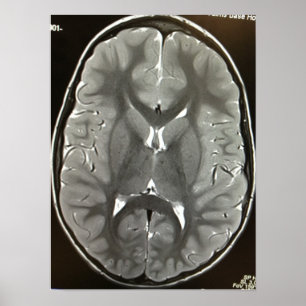 Poster do cérebro de MRI