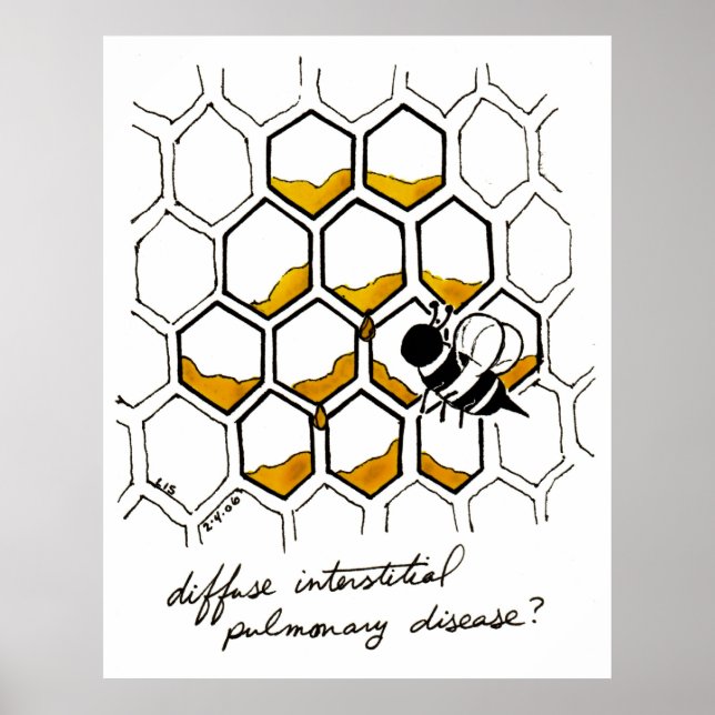 Poster Doença pulmonar intersticial difusa (Frente)