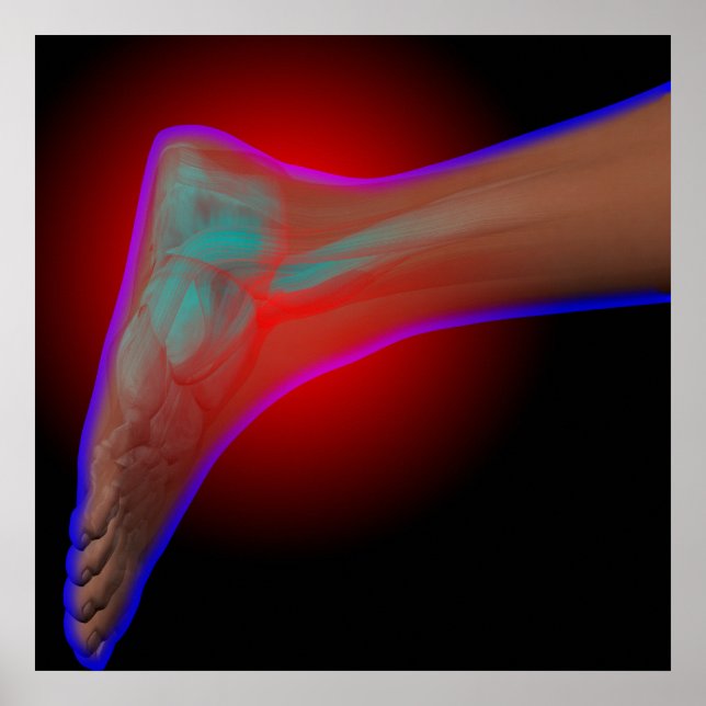 Pôster Dor no Ankle (Frente)