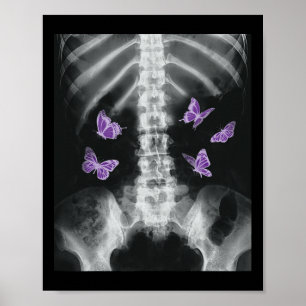 Poster Egirl Xray Skeleton Pink Butterfly Harajuku Y2k Da