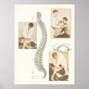 Poster espinal do ajuste da quiroterapia