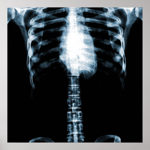 POSTER ESQUELETÃO X-RAY TORSO RIBS - AZUL