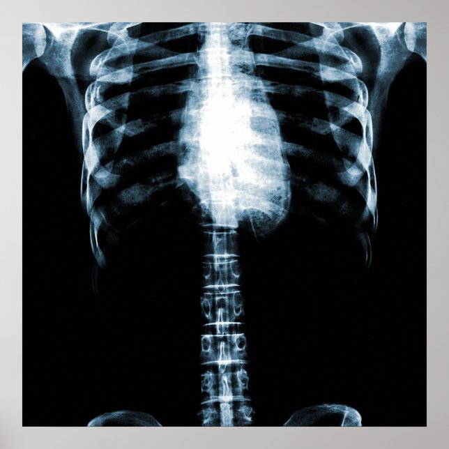 POSTER ESQUELETÃO X-RAY TORSO RIBS - AZUL (Frente)