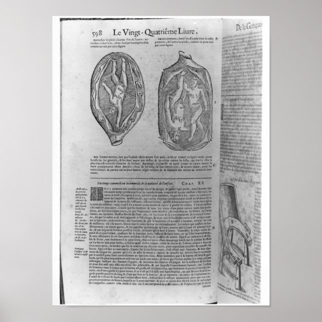 Pôster Feto, ilustração de "Oeuvres" (Frente)