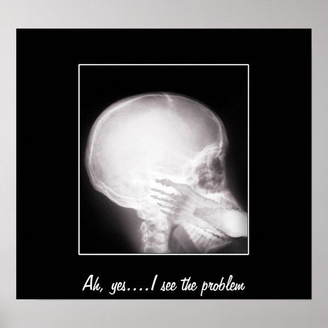 Pôster Foto em raio-X da boca (Frente)