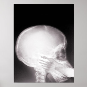 Pôster Foto em raio-X da boca