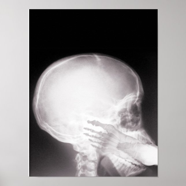 Pôster Foto em raio-X da boca (Frente)