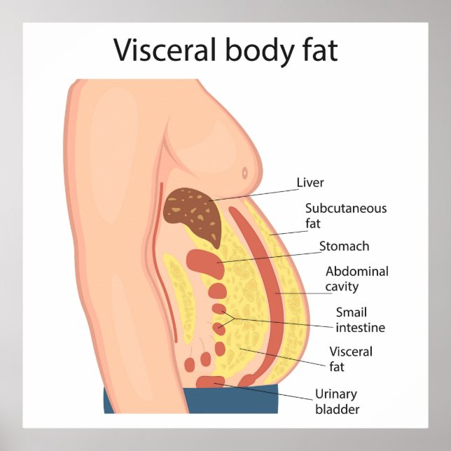 Poster Gordura do corpo visceral (Frente)