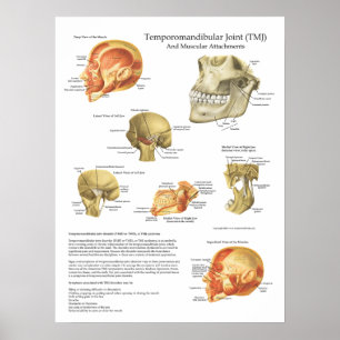 Pôster Gráfico de Acessos Musculares Anatômicos TMJ Médic
