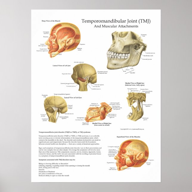 Pôster Gráfico de Acessos Musculares Anatômicos TMJ Médic (Frente)