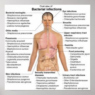 Poster Gráfico de infecções bacterianas em seres h