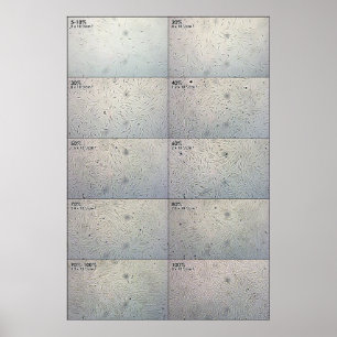 Pôster Gráfico de seguimento da influência