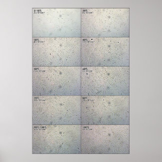 Pôster Gráfico de seguimento da influência