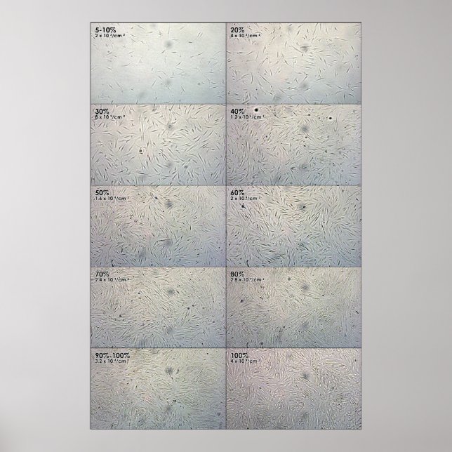 Pôster Gráfico de seguimento da influência (Frente)