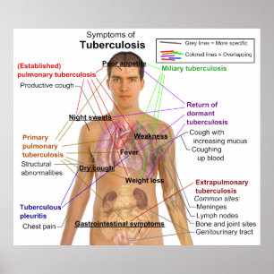 Pôster Gráfico de Sintomas da Tuberculose no Homem