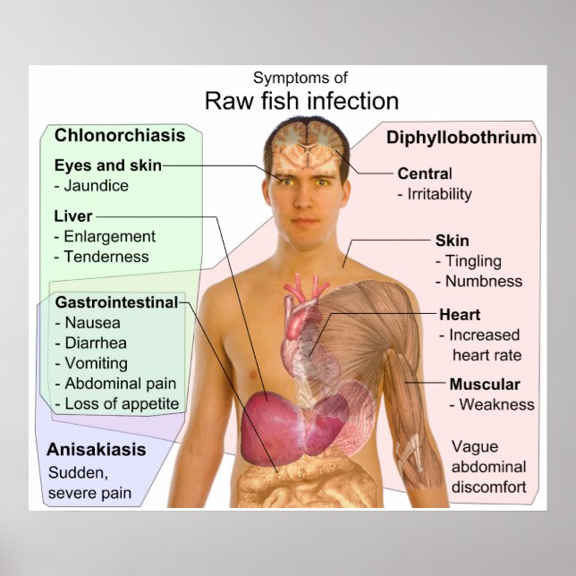 Pôster Gráfico de Sintomas de uma Infecção Bruta de Peixe (Frente)
