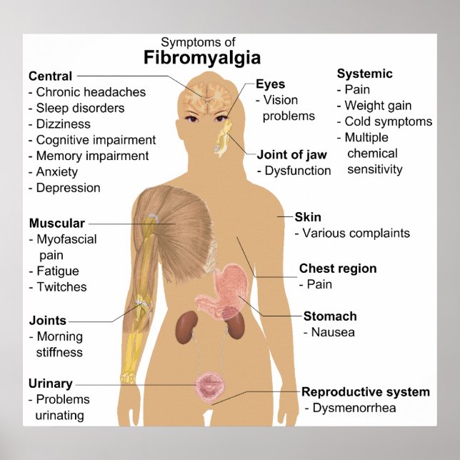 Pôster Gráfico dos Sintomas da Fibromialgia (Frente)
