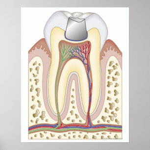 Poster Ilustração do enchimento dental