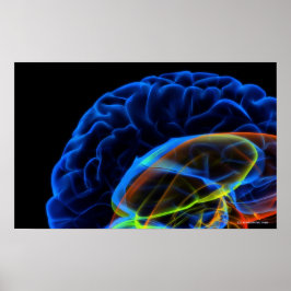 Poster Imagem de raio X do cérebro