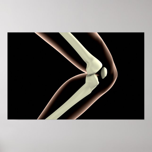 Poster Imagem De Raios X Do Joelho 1 (Frente)