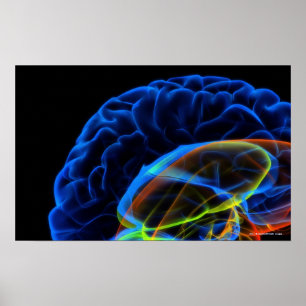 Poster Imagem do raio X do cérebro