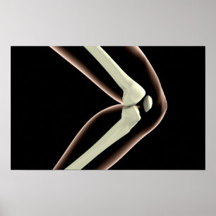 Poster Imagem do raio X do joelho 1