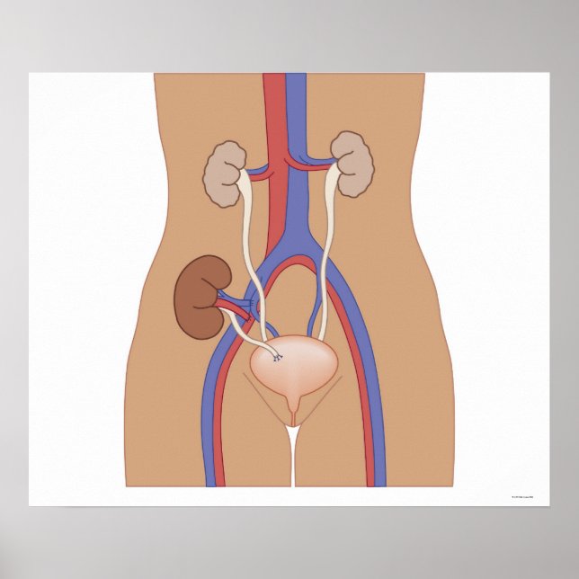 Pôster Kidney Transplant (Frente)